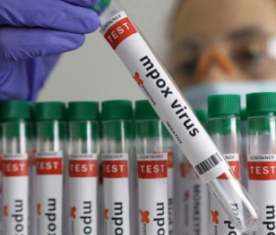 Małpia ospa szybko mutuje i wymknęła się z Afryki